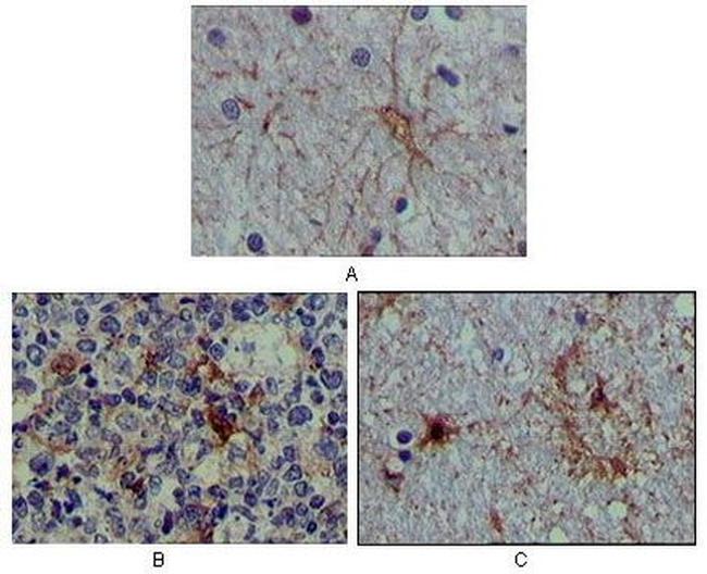 S100A1 Antibody in Immunohistochemistry (Paraffin) (IHC (P))