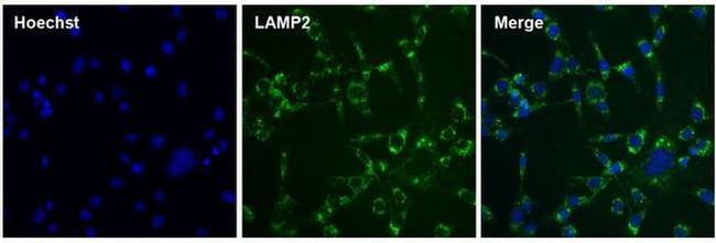 Rat IgG (H+L) Cross-Adsorbed Secondary Antibody in Immunocytochemistry (ICC/IF)