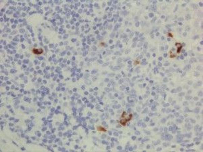 Human IgG3 Secondary Antibody in Immunohistochemistry (IHC)