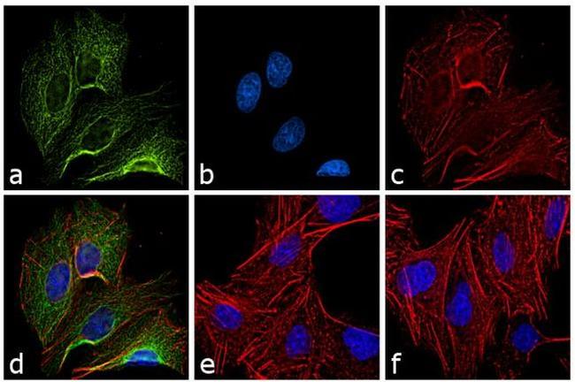 Rat IgG (H+L) Cross-Adsorbed Secondary Antibody in Immunocytochemistry (ICC/IF)