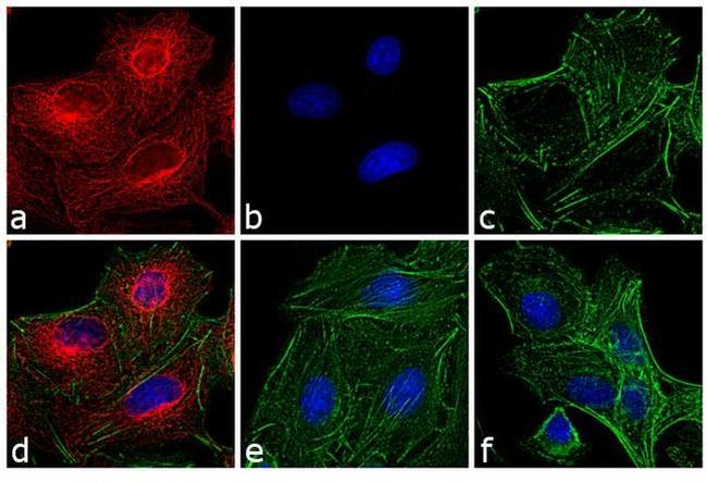 Rat IgG (H+L) Cross-Adsorbed Secondary Antibody in Immunocytochemistry (ICC/IF)