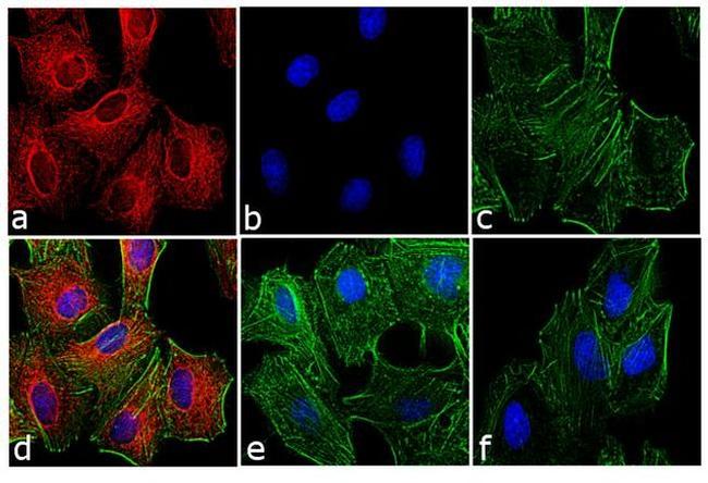 Rat IgG (H+L) Cross-Adsorbed Secondary Antibody in Immunocytochemistry (ICC/IF)