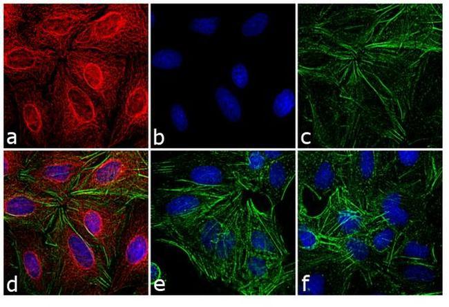 Rat IgG (H+L) Cross-Adsorbed Secondary Antibody in Immunocytochemistry (ICC/IF)