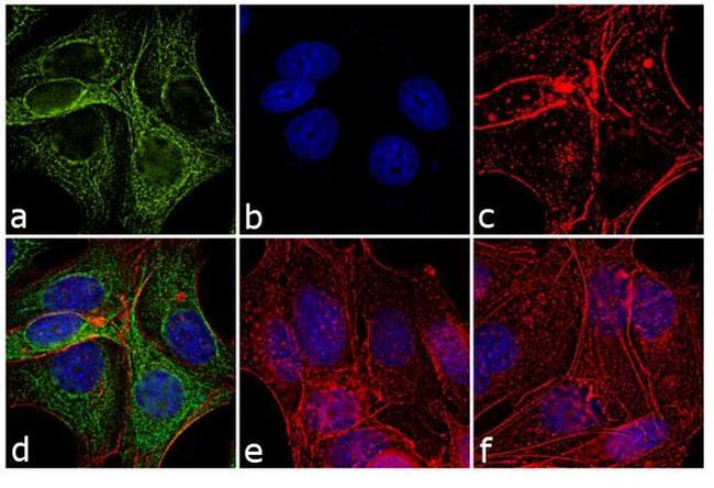 Mouse IgG (H+L) Cross-Adsorbed Secondary Antibody in Immunocytochemistry (ICC/IF)