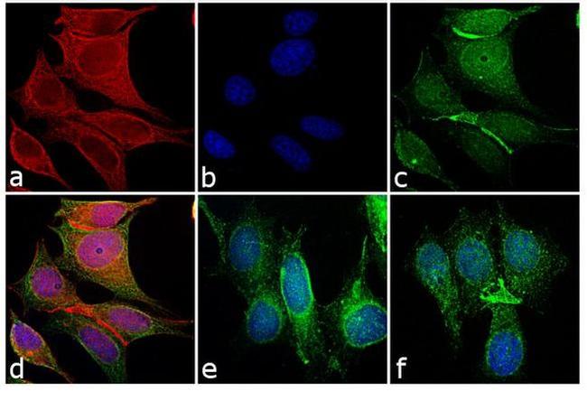 Mouse IgG (H+L) Cross-Adsorbed Secondary Antibody in Immunocytochemistry (ICC/IF)