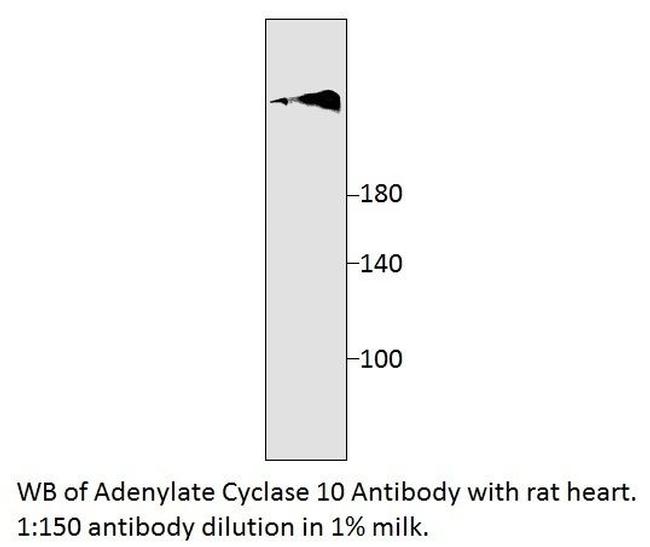 Adenylate Cyclase 10 Antibody in Western Blot (WB)