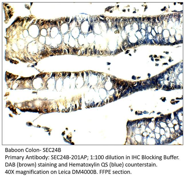 SEC24B Antibody in Immunohistochemistry (IHC)