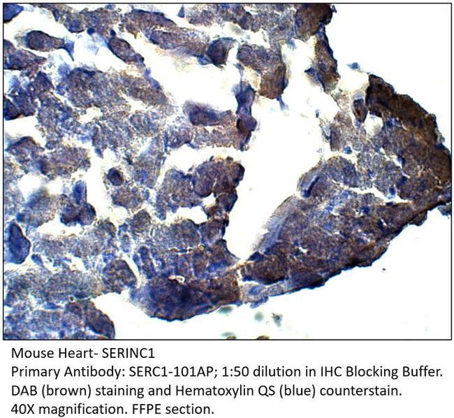 SERINC1 Antibody in Immunohistochemistry (IHC)