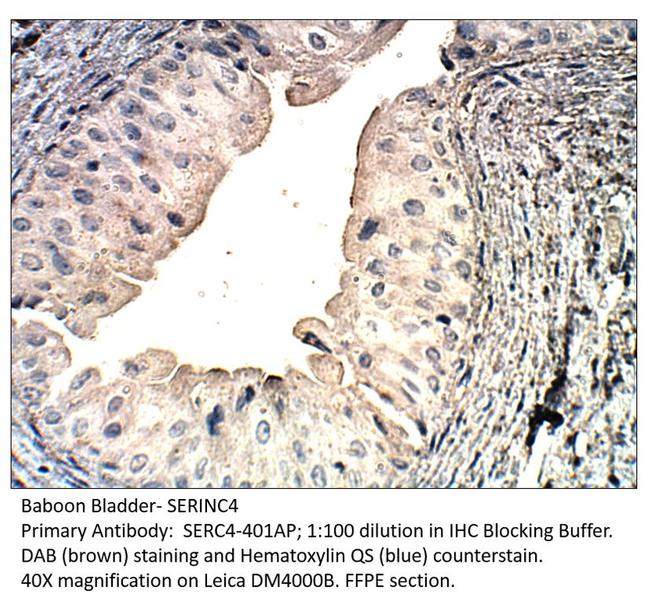 SERINC4 Antibody in Immunohistochemistry (IHC)