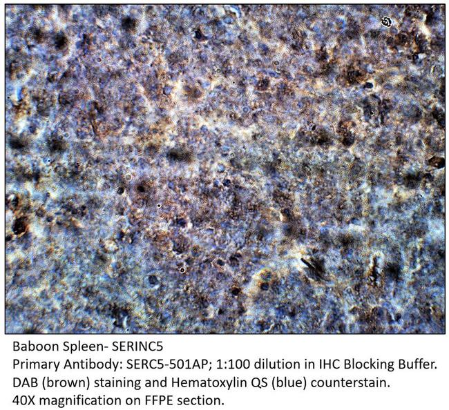 SERINC5 Antibody in Immunohistochemistry (IHC)