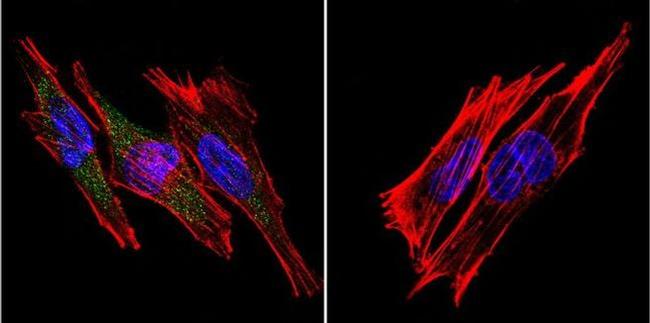 SERCA1 ATPase Antibody in Immunocytochemistry (ICC/IF)