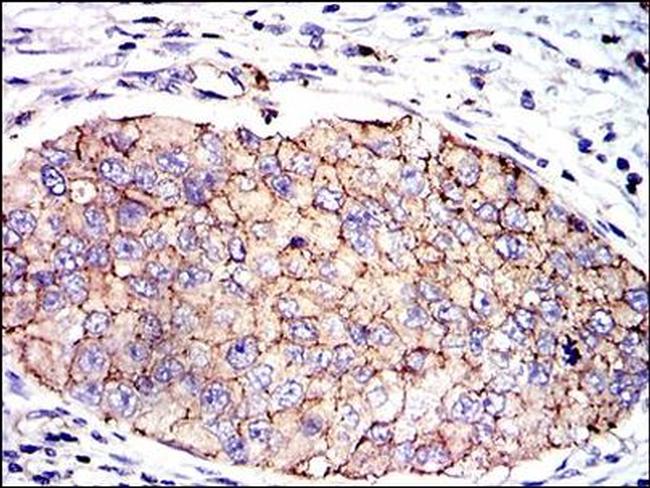 PAI1 Antibody in Immunohistochemistry (Paraffin) (IHC (P))