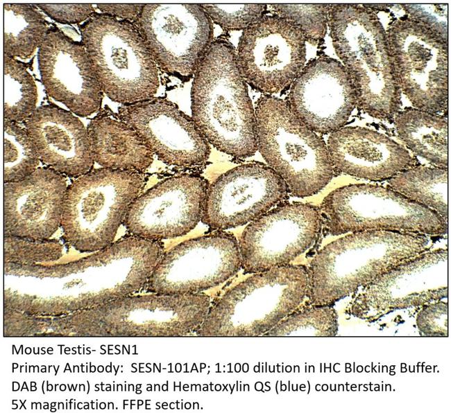 SESN1 Antibody in Immunohistochemistry (IHC)