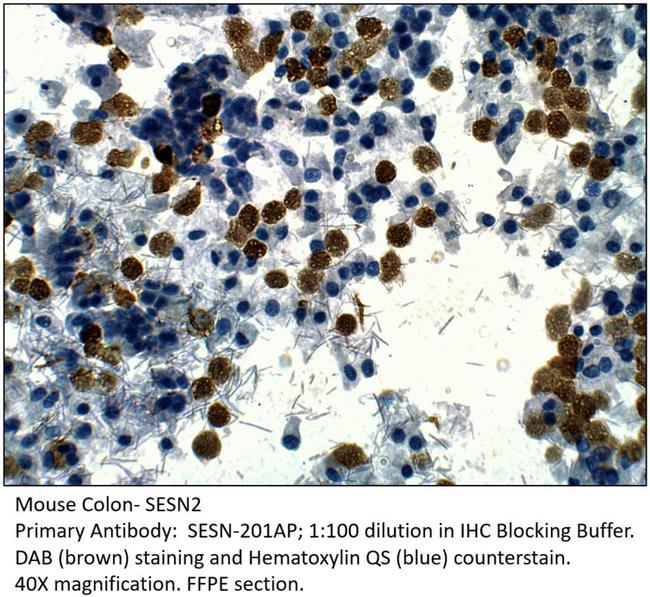 SESN2 Antibody in Immunohistochemistry (IHC)