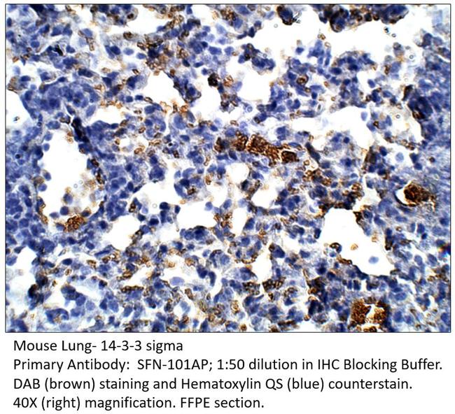 14-3-3 sigma Antibody in Immunohistochemistry (IHC)