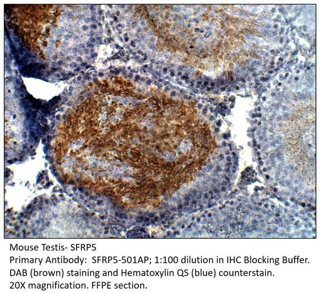 SFRP5 Antibody in Immunohistochemistry (IHC)