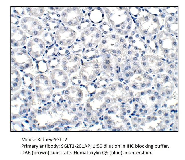 SGLT2 Antibody in Immunohistochemistry (IHC)