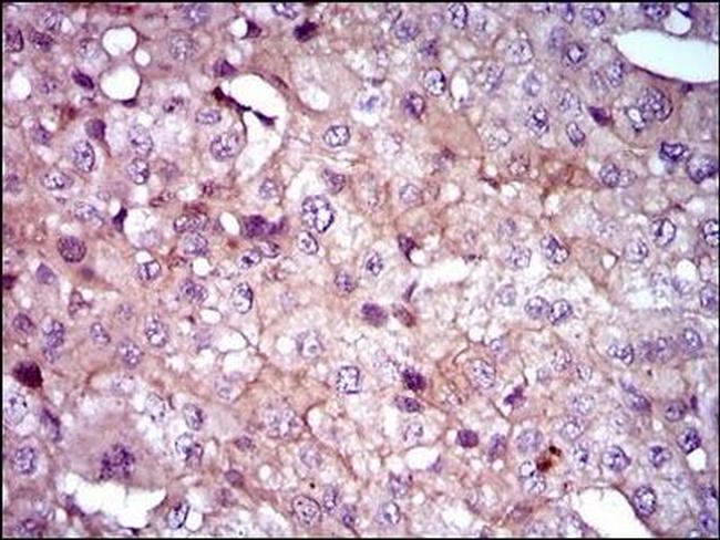 SHH Antibody in Immunohistochemistry (Paraffin) (IHC (P))