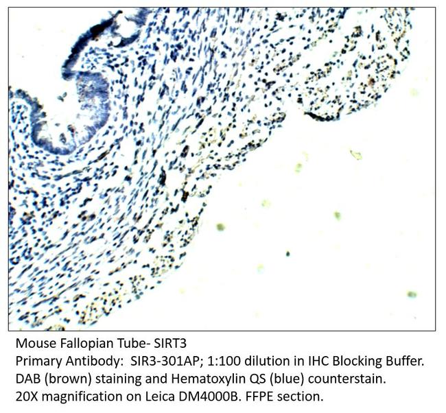 SIRT3 Antibody in Immunohistochemistry (IHC)