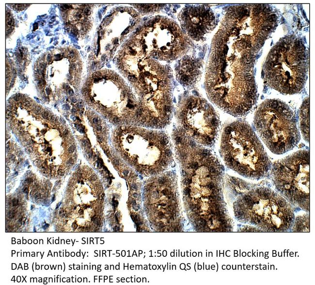 SIRT5 Antibody in Immunohistochemistry (IHC)