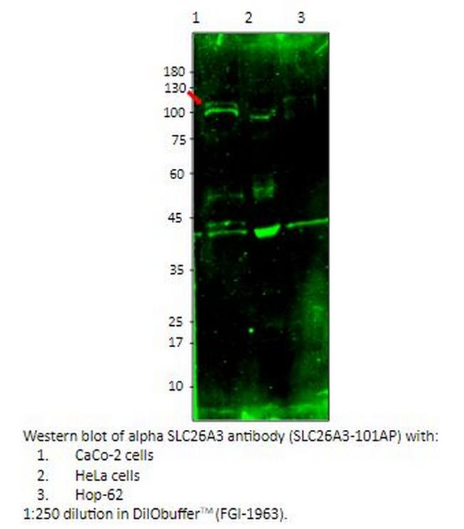 SLC26A3 Antibody in Western Blot (WB)