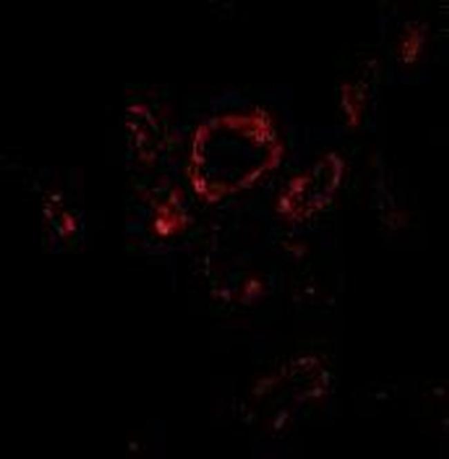 SLUG Antibody in Immunohistochemistry (IHC)