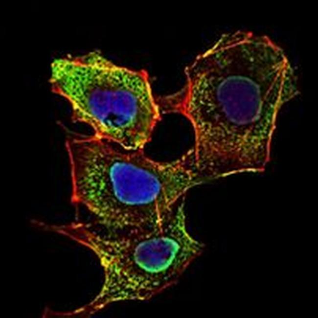 SMAD3 Antibody in Immunocytochemistry (ICC/IF)