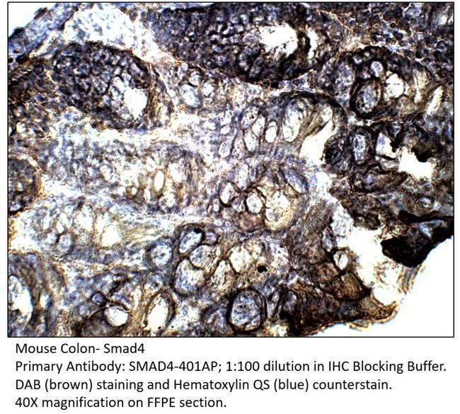 Smad4 Antibody in Immunohistochemistry (IHC)