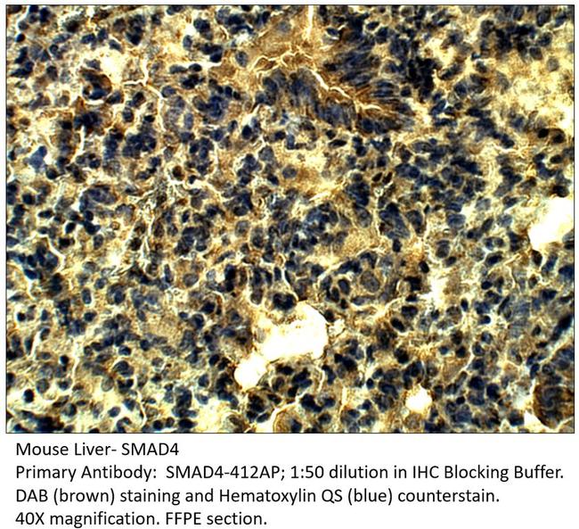 Smad4 Antibody in Immunohistochemistry (IHC)