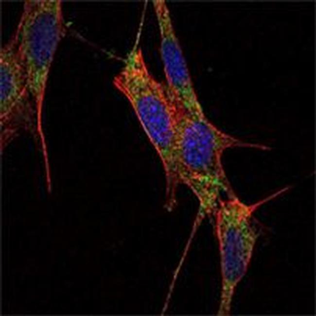 SMAD4 Antibody in Immunocytochemistry (ICC/IF)