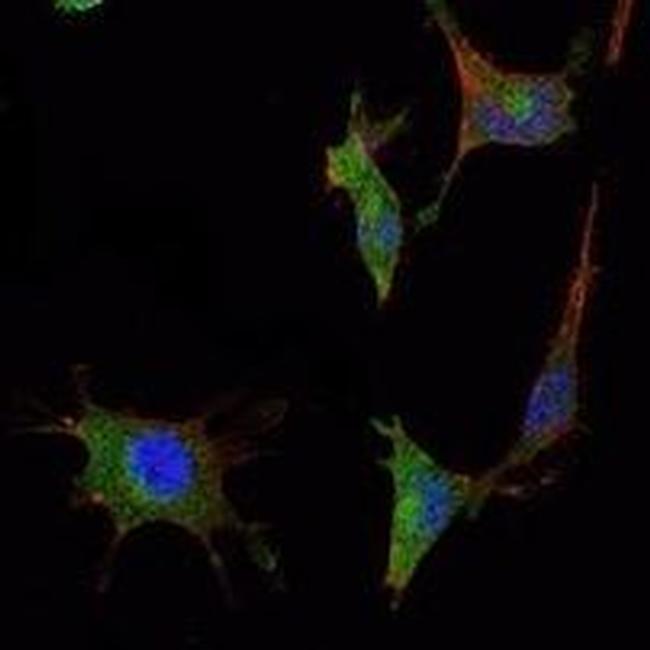 SMAD5 Antibody in Immunocytochemistry (ICC/IF)