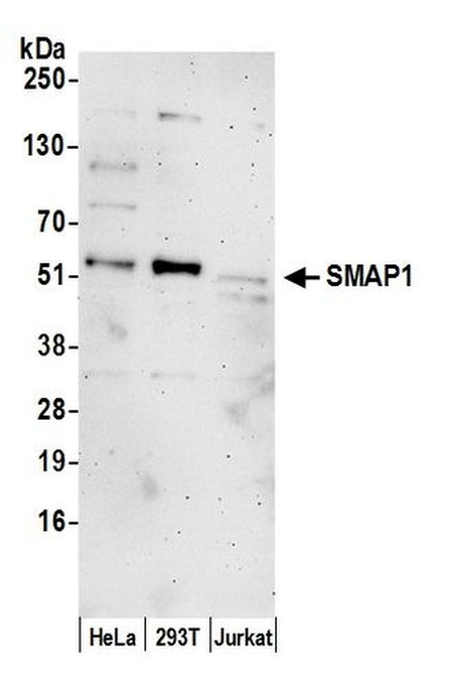 SMAP1 Antibody in Western Blot (WB)