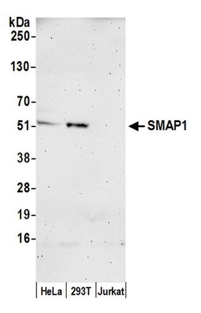 SMAP1 Antibody in Western Blot (WB)