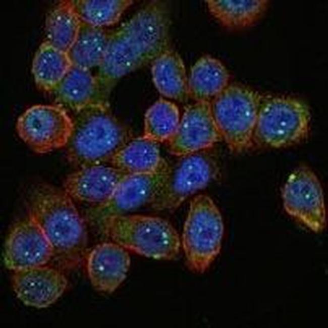 SMN1 Antibody in Immunocytochemistry (ICC/IF)