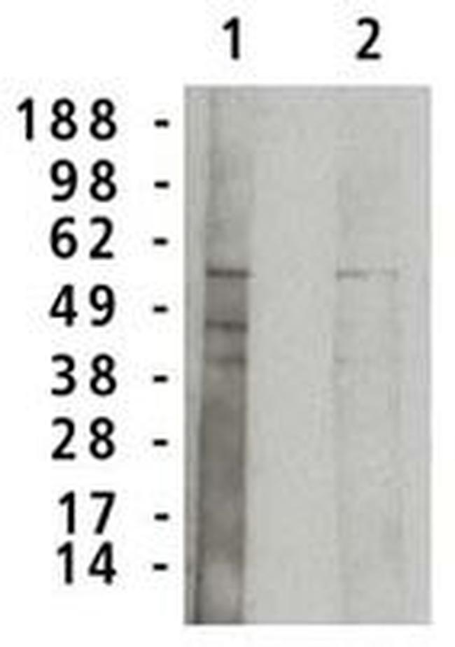 ASM Antibody in Western Blot (WB)