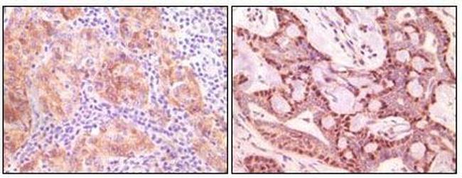 gamma Synuclein Antibody in Immunohistochemistry (Paraffin) (IHC (P))