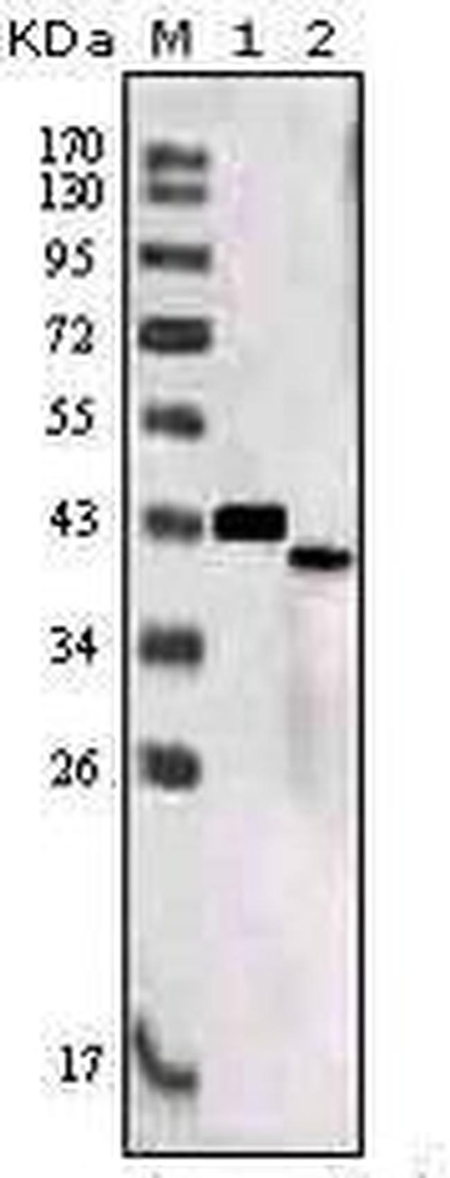 SORL1 Antibody in Western Blot (WB)