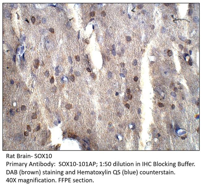 SOX10 Antibody in Immunohistochemistry (IHC)