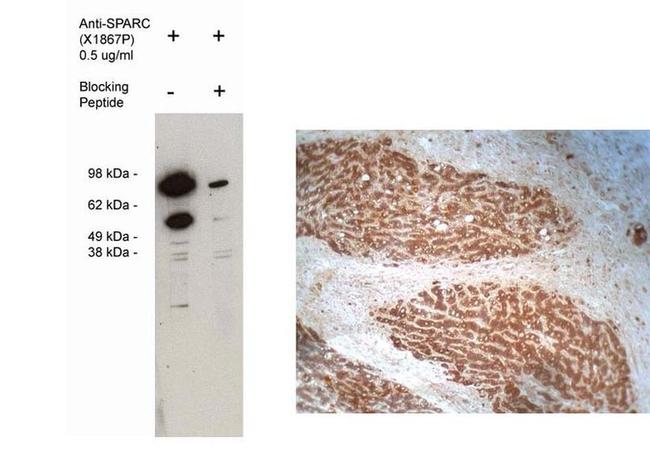 SPARC Antibody in Immunohistochemistry (IHC)