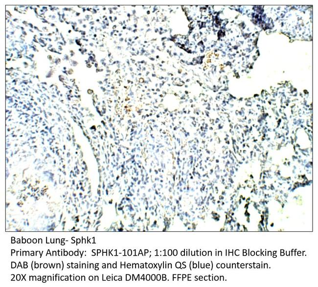 SPHK1 Antibody in Immunohistochemistry (IHC)