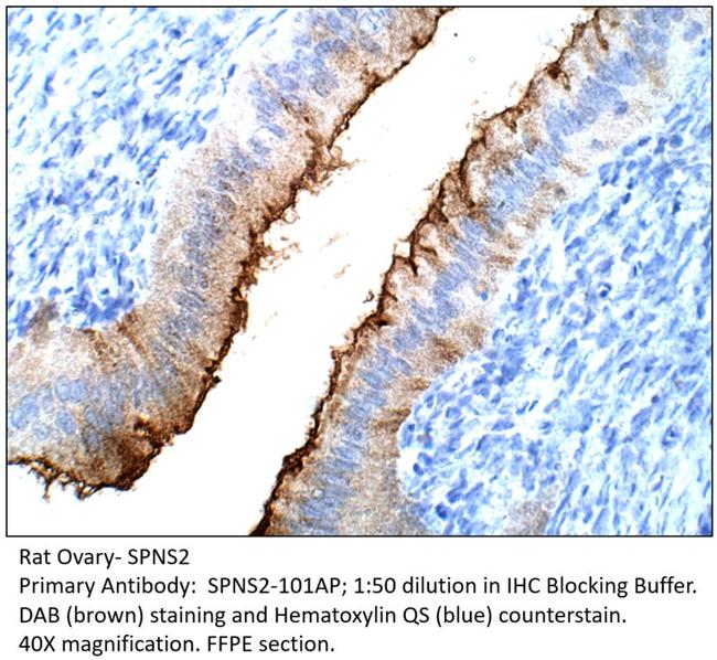 SPNS2 Antibody in Immunohistochemistry (IHC)