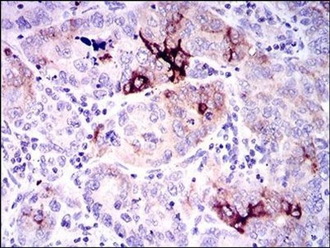 Osteopontin Antibody in Immunohistochemistry (Paraffin) (IHC (P))