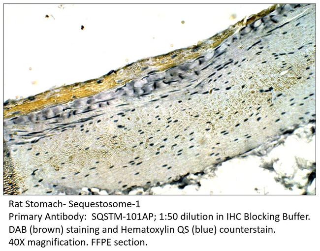 Sequestosome-1 Antibody in Immunohistochemistry (Paraffin) (IHC (P))