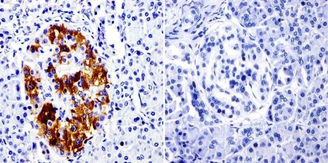 SRC3 Antibody in Immunohistochemistry (Paraffin) (IHC (P))