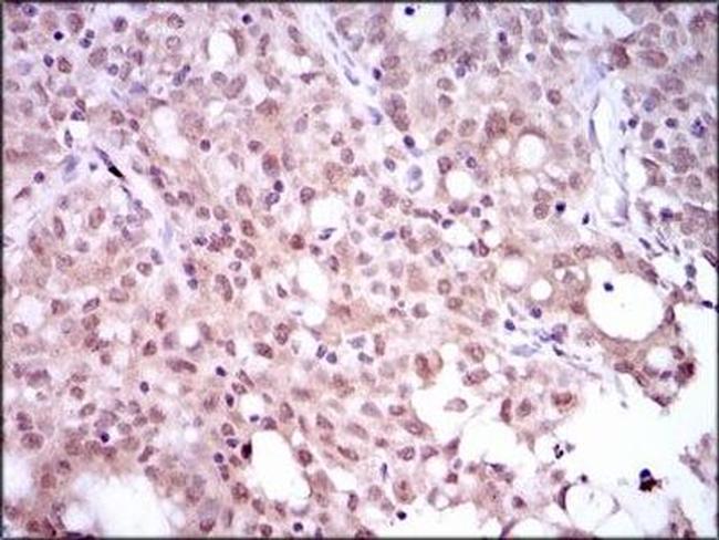 SRY Antibody in Immunohistochemistry (Paraffin) (IHC (P))