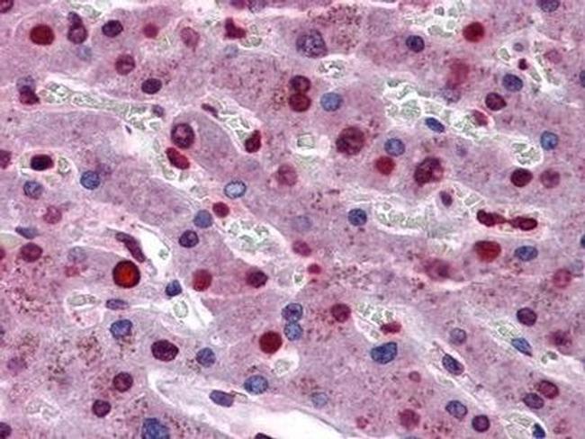 STAT3 Antibody in Immunohistochemistry (Paraffin) (IHC (P))