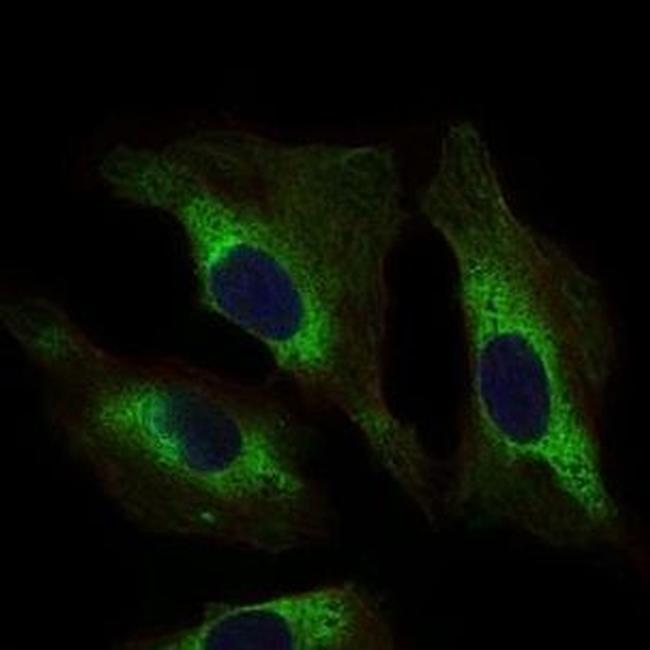 STAT5 alpha Antibody in Immunocytochemistry (ICC/IF)