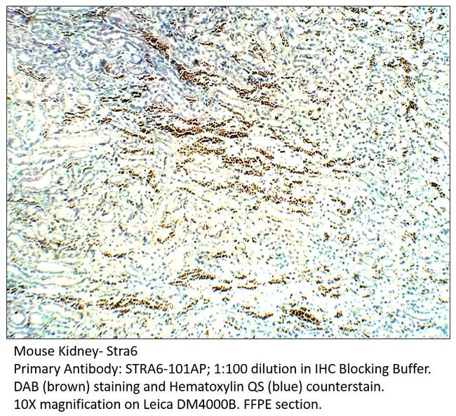 Stra6 Antibody in Immunohistochemistry (IHC)