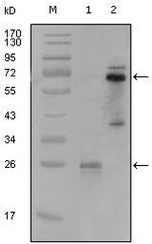 SLC22A1 Antibody in Western Blot (WB)