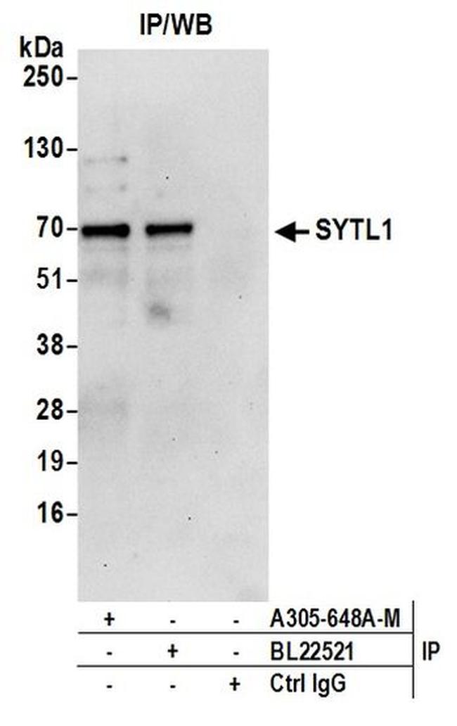 SYTL1 Antibody in Immunoprecipitation (IP)